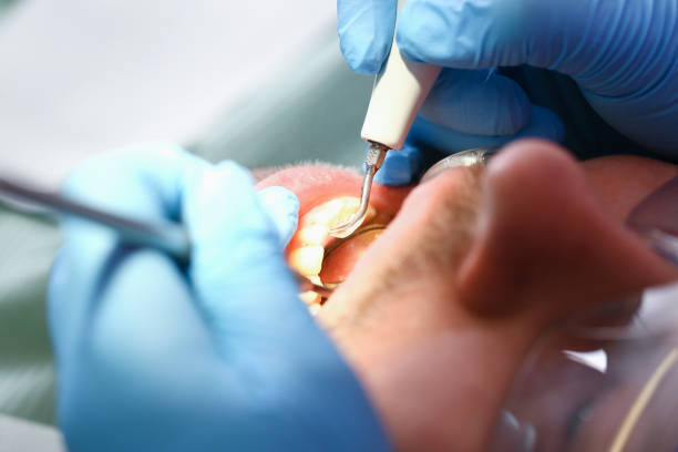 Best Emergency Pediatric Dental Care in South Lebanon, OH