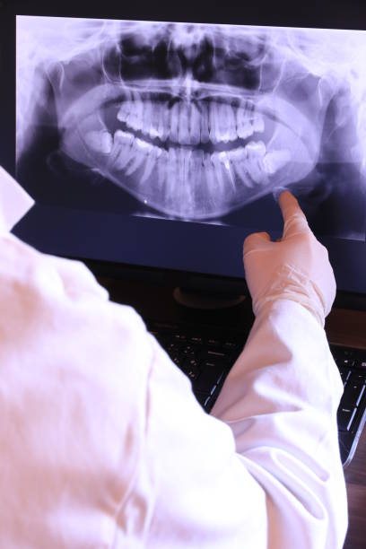 Best Emergency Care for Gum Disease in South Lebanon, OH