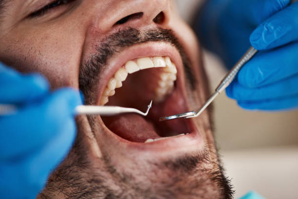 Best Emergency Dental Care for Sports Injuries in South Lebanon, OH